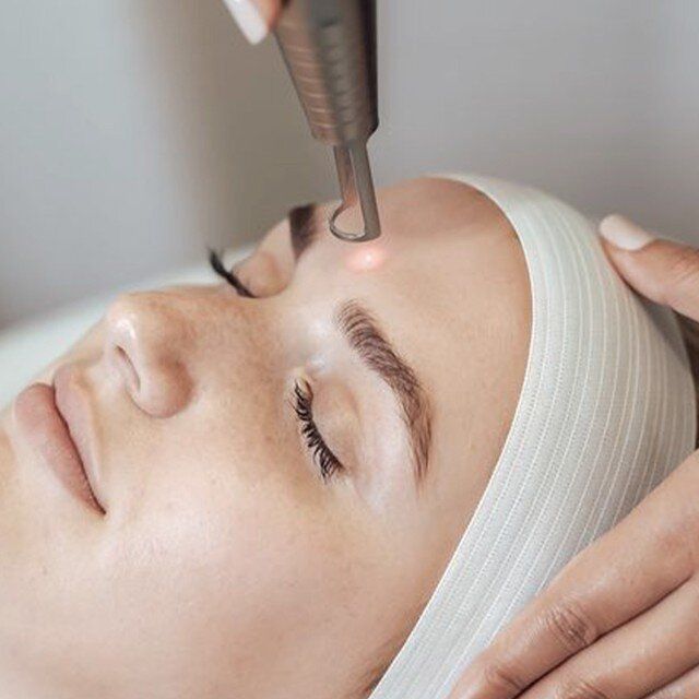 Fotona Pico Skin Rejuvenation