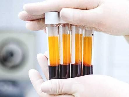 PRP Skin Rejuvenation