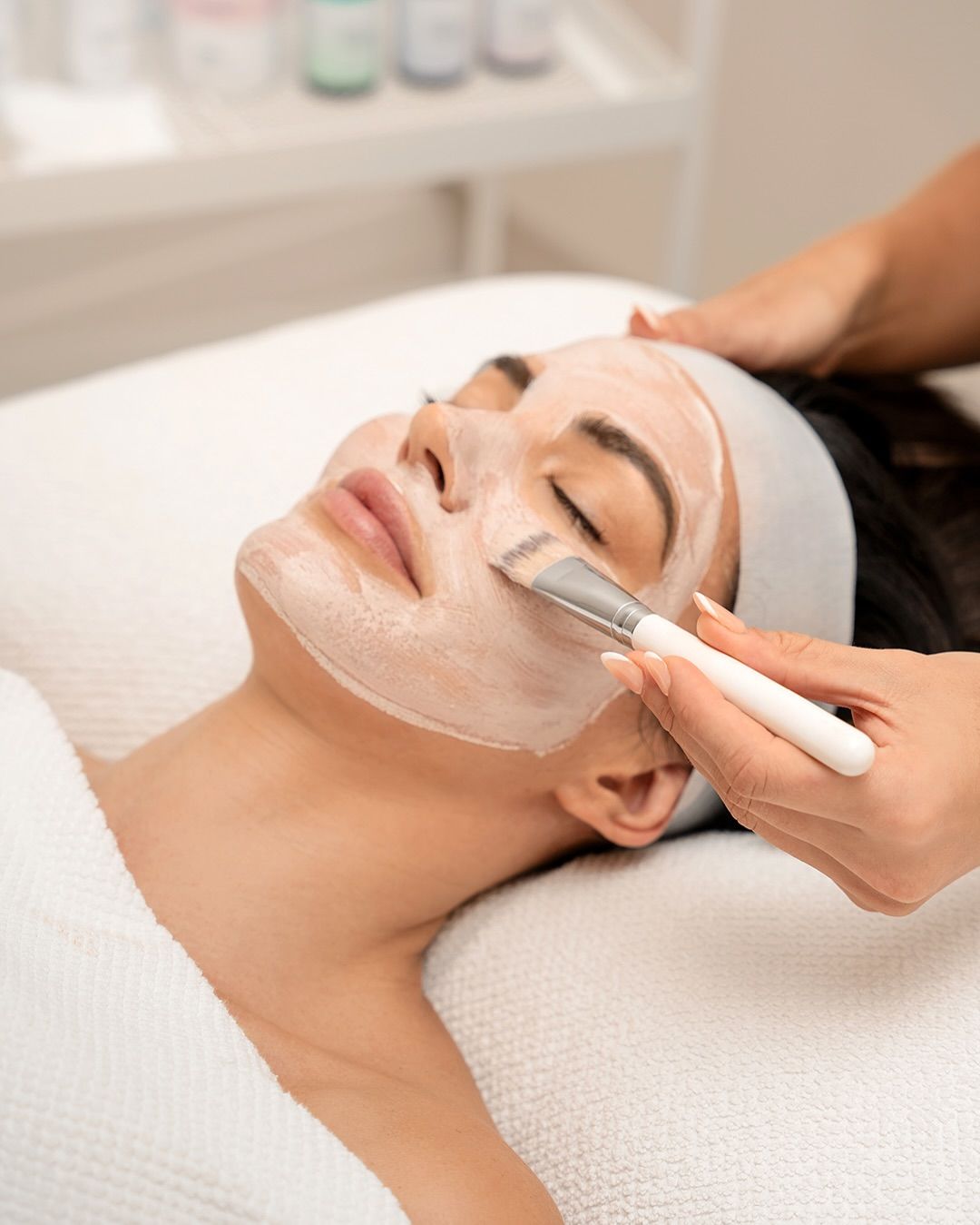 Chemical Peel